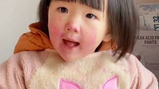 2岁宝宝偷吃火龙果，小脸比猴屁股还红弄的满屋都是，妈妈气的头疼#超值好物省心选 商城低价秒杀