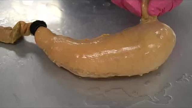 当我们吃太多，胃会怎么样呢？