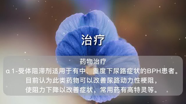 良性前列腺增生(24)