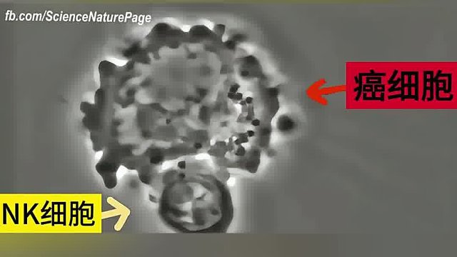 NK细胞击溃癌细胞