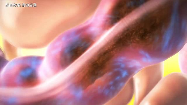 为什么拉稀比正常拉粪便更痛？神奇的冷知识