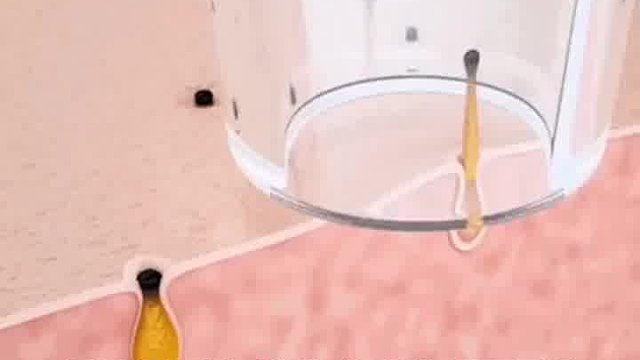 轻松解决鼻子上的黑头 或者你还有更方便的办法吗 一起讨论