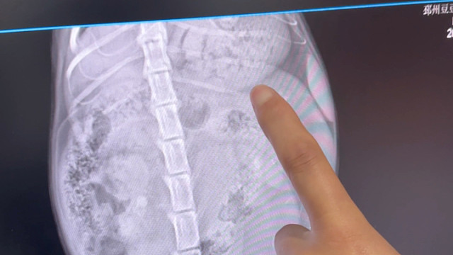 我怎么也没想到我一个多月前捡到的小奶牛是带娃来投奔我的