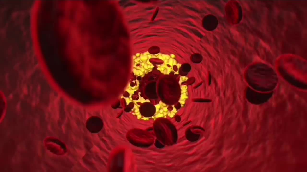 特发性震颤引起的怎么办