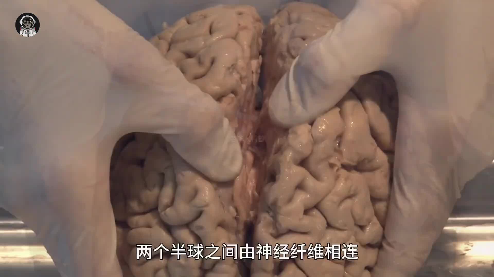 108. 你的大脑是如何运作的，它的结构与功能远超你的想象