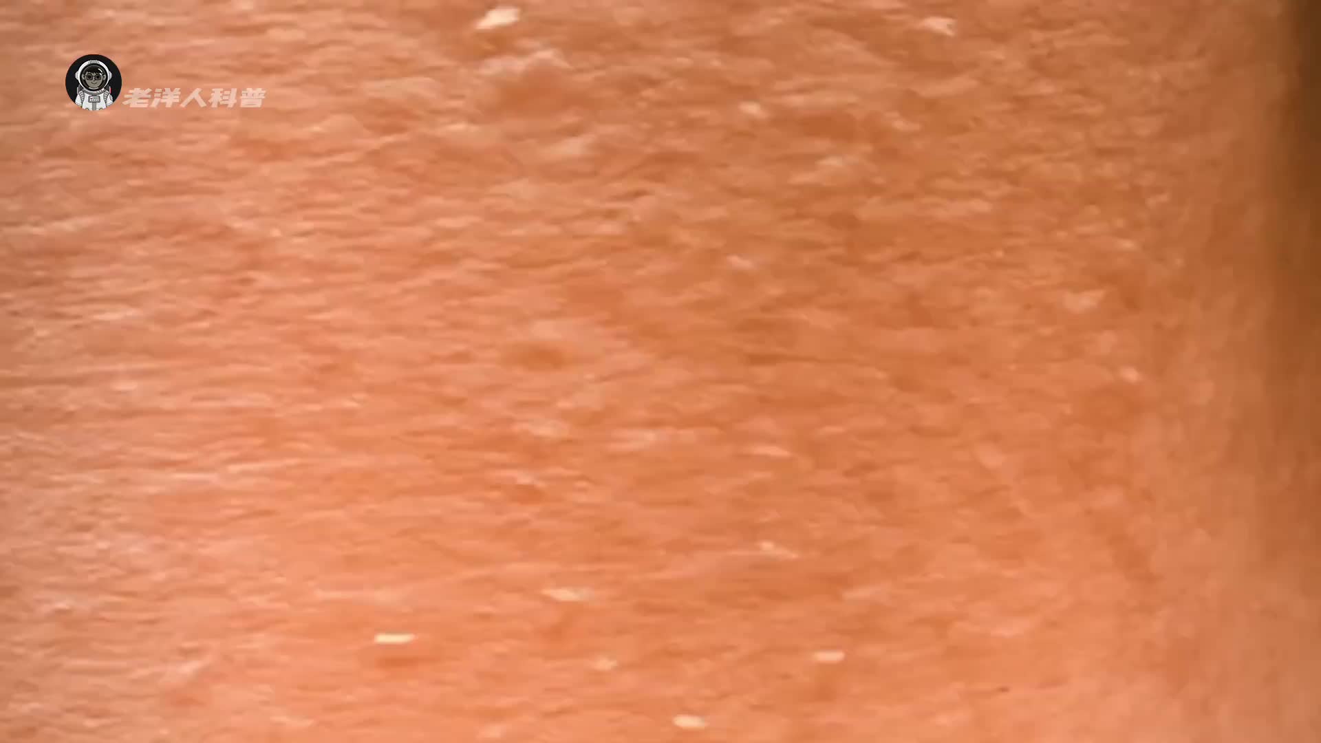 11. 结痂到底该不该抠掉呢？一定要看到最后