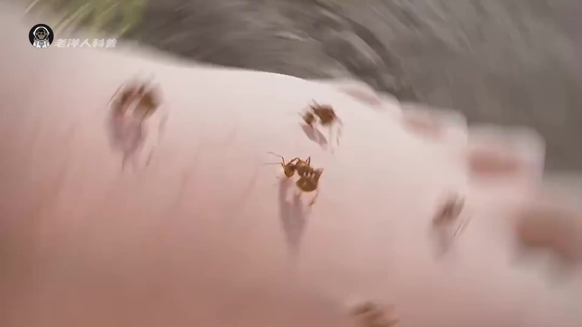 17. 原来蚂蚁咬人并不是用钳子，看完你就明白了