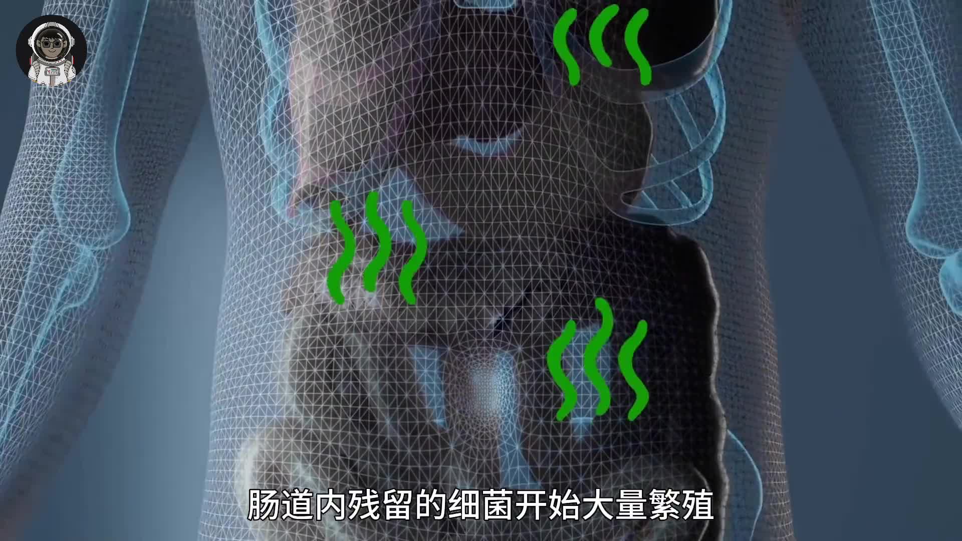 181. 你知道一具尸体的腐败程度究竟有多快吗？