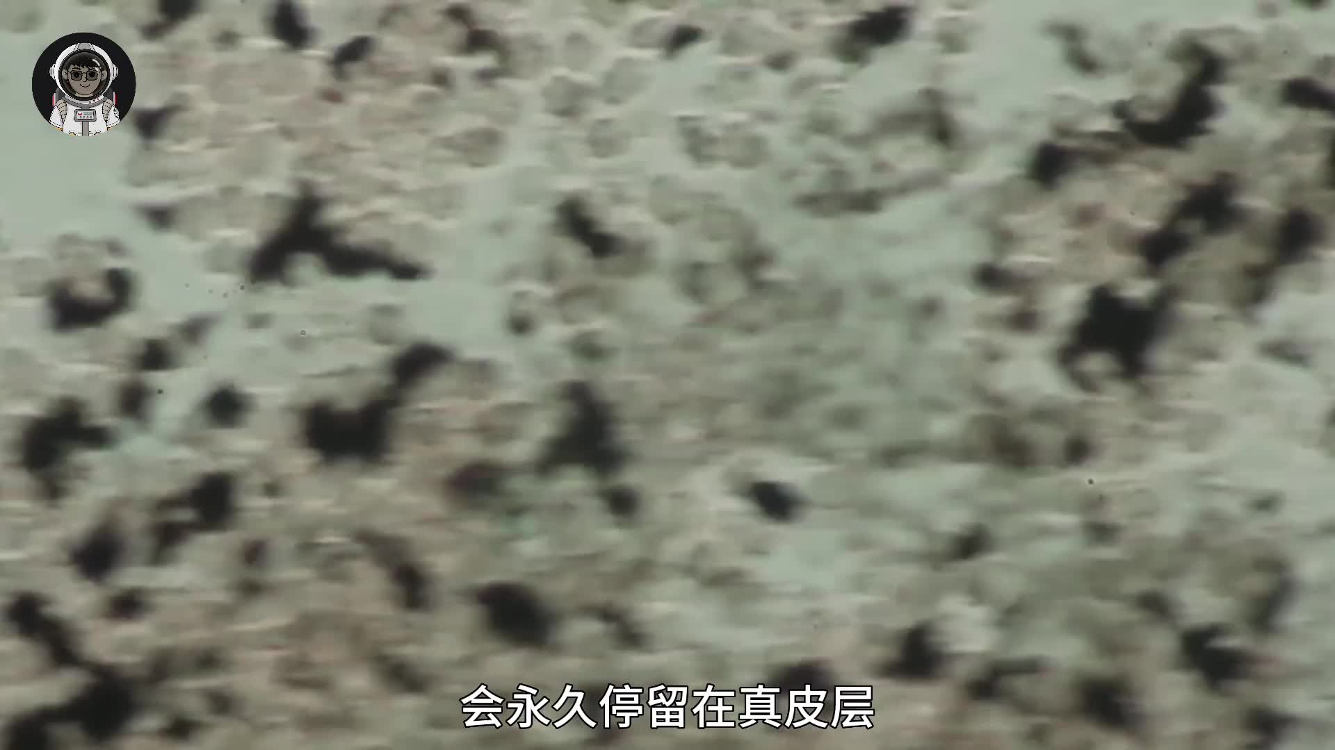 202. 你知道纹身的清洗过程究竟有多恐怖吗？它到底是怎么洗掉的？