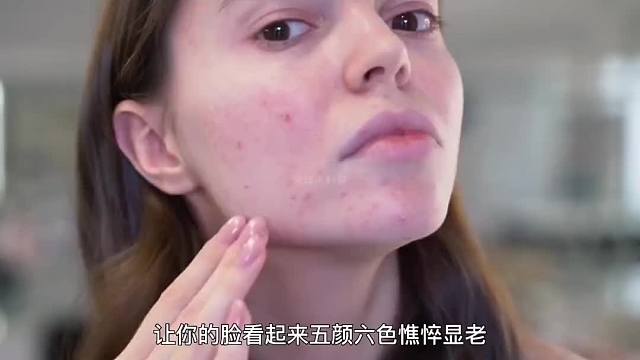 257. 换季引起的肌肤问题，到底有哪些？