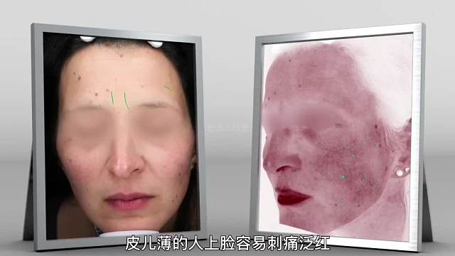 275. 长期熬夜对皮肤的危害究竟有多大？