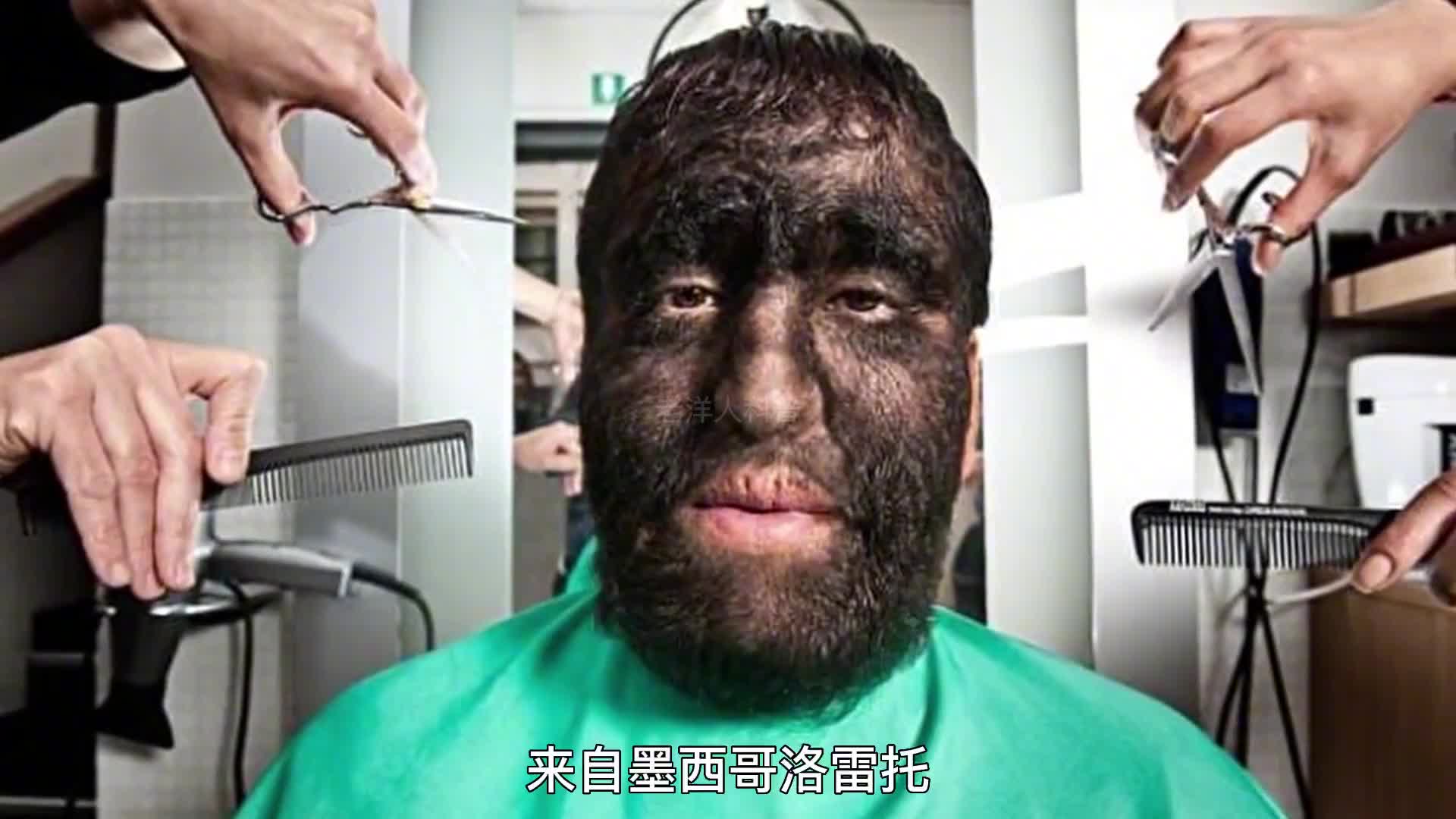 296. 这些百万分之一的人，究竟有多奇特？