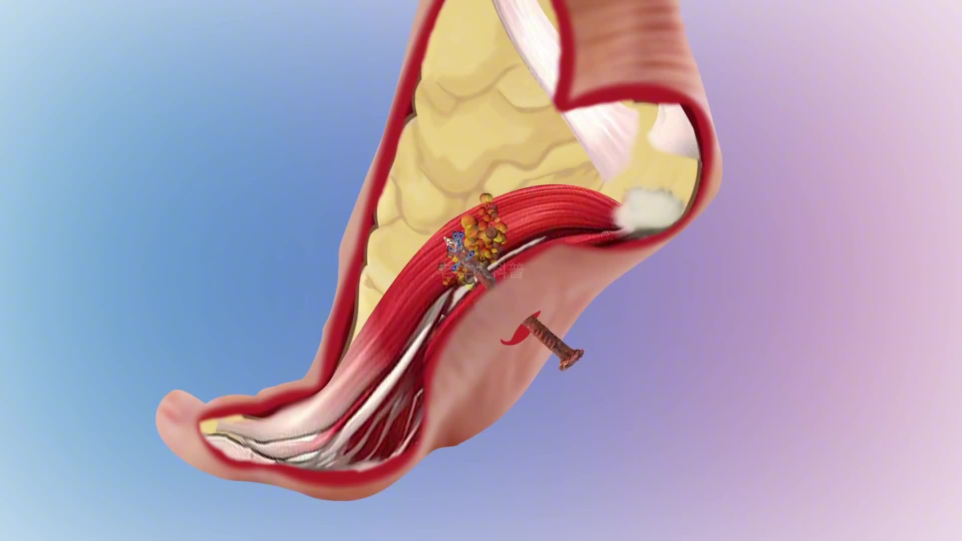 305. 人类最恐惧的五种疼痛极限，经历过的都是硬汉。