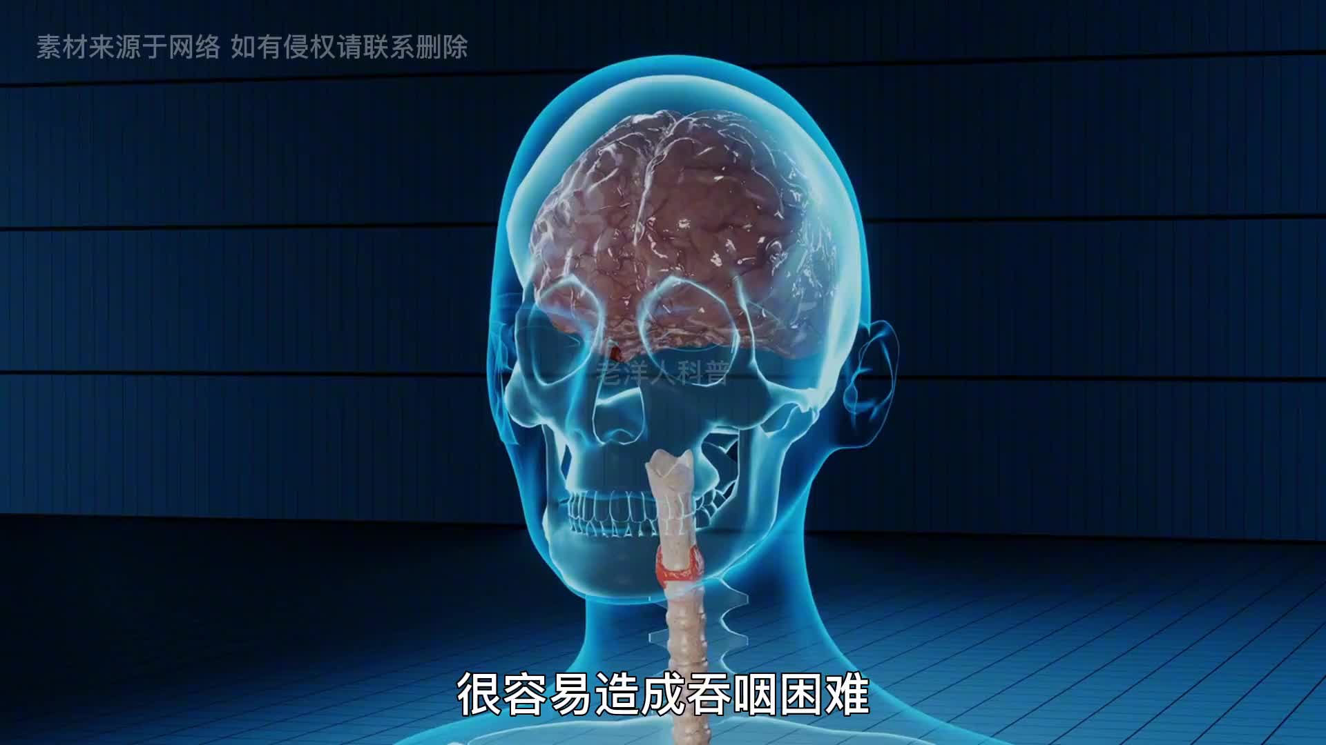 313. 世界上最危险的三种糖果，看看你都吃过几种！