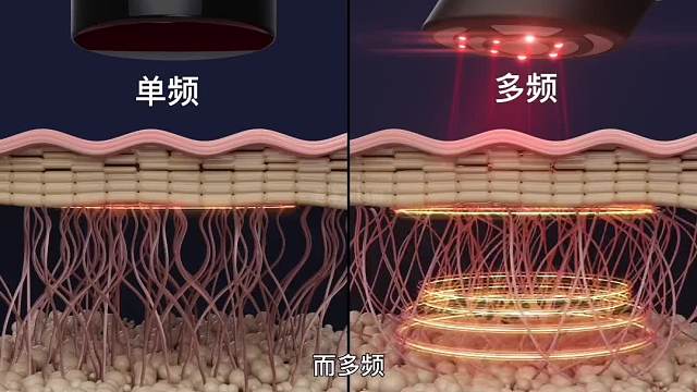 339. 如何延缓皱纹的产生，掌握逆龄的秘密，一定要认真看完！