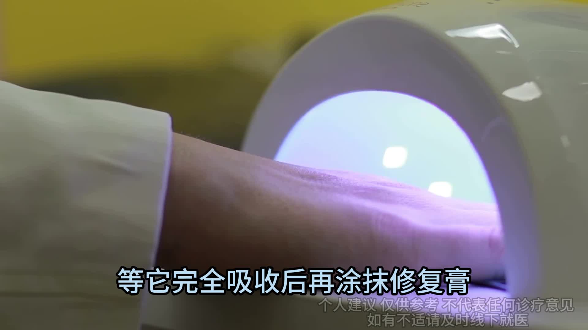 根治灰指甲别走弯路了！过来人在线支招，效果胜10瓶特效药！