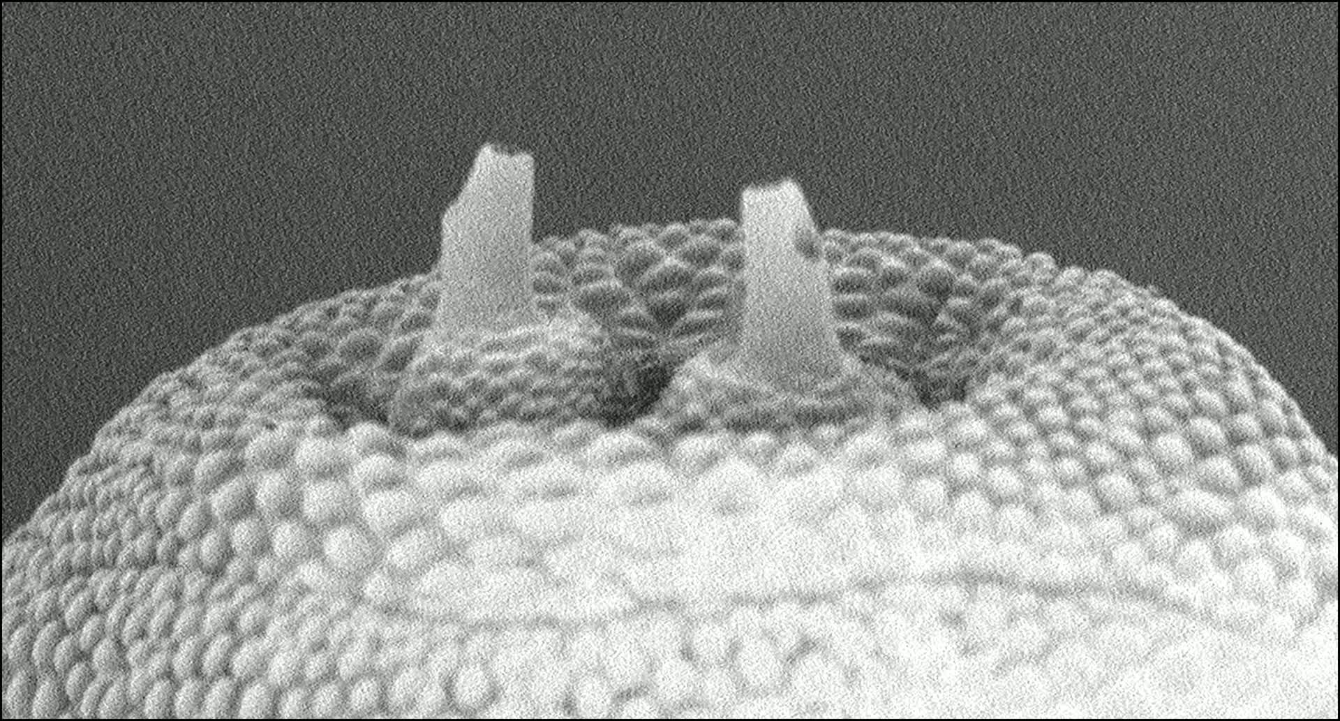 苍蝇为什么会携带病毒呢？
