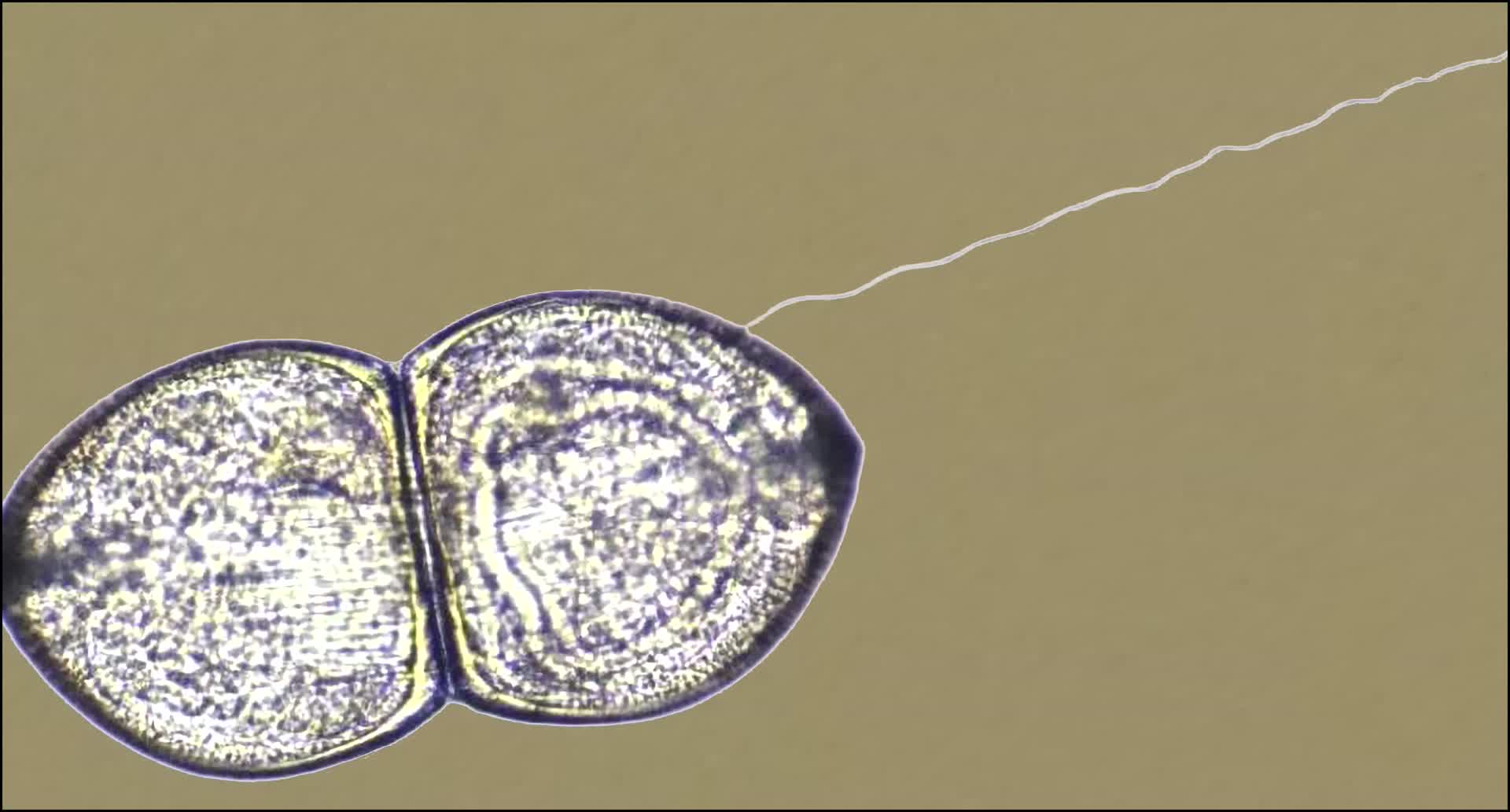 河蚌是怎么样被感染的