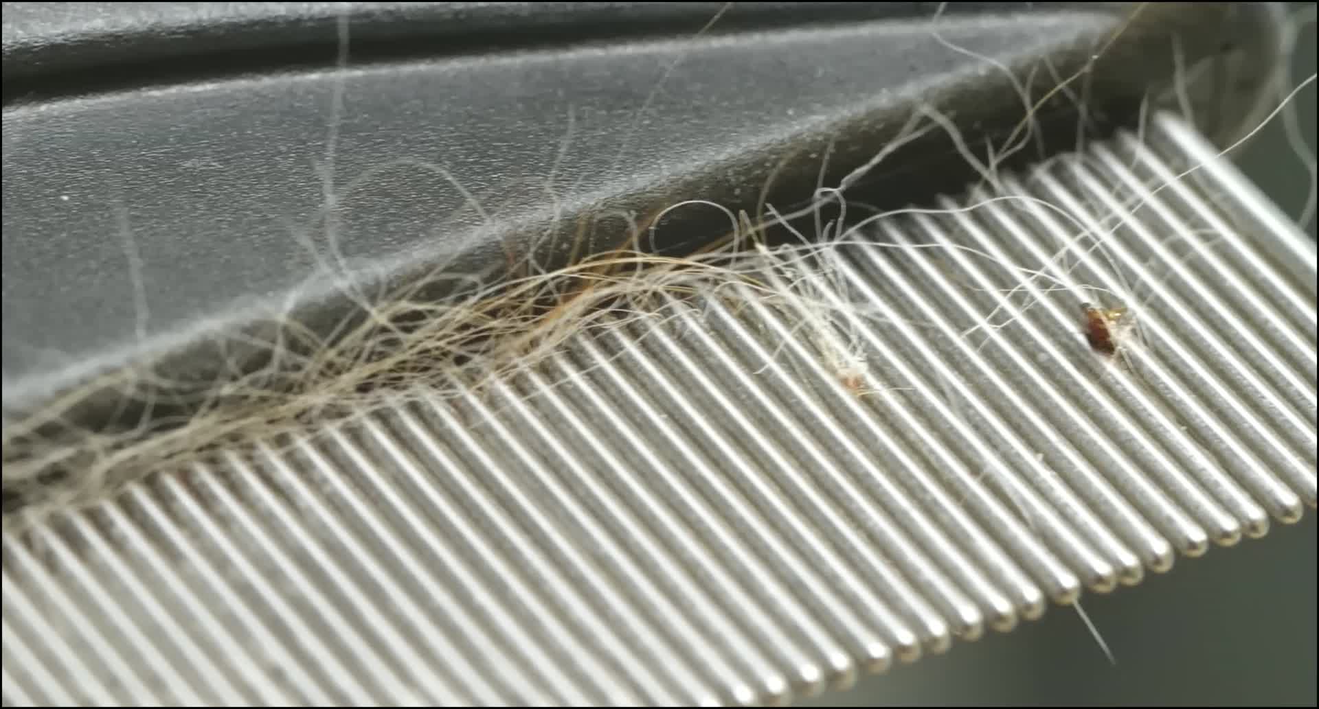 虱子是怎么生长出来的