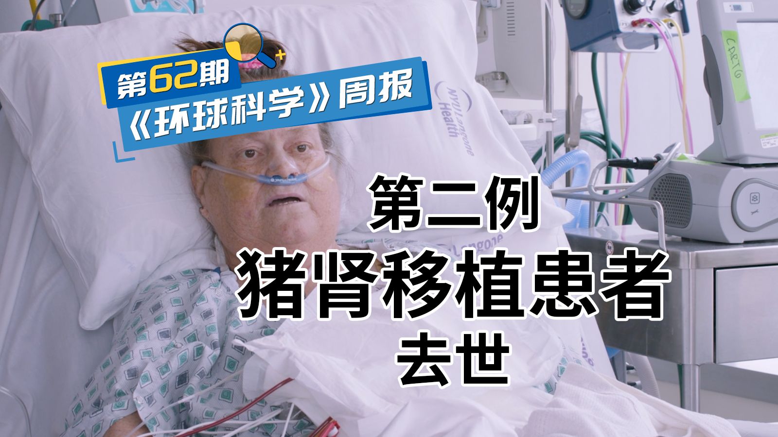 因移植猪肾衰竭，被迫摘除33天后，全球第二例猪肾移植患者去世（本期有福利）｜《环球科学》周报062期