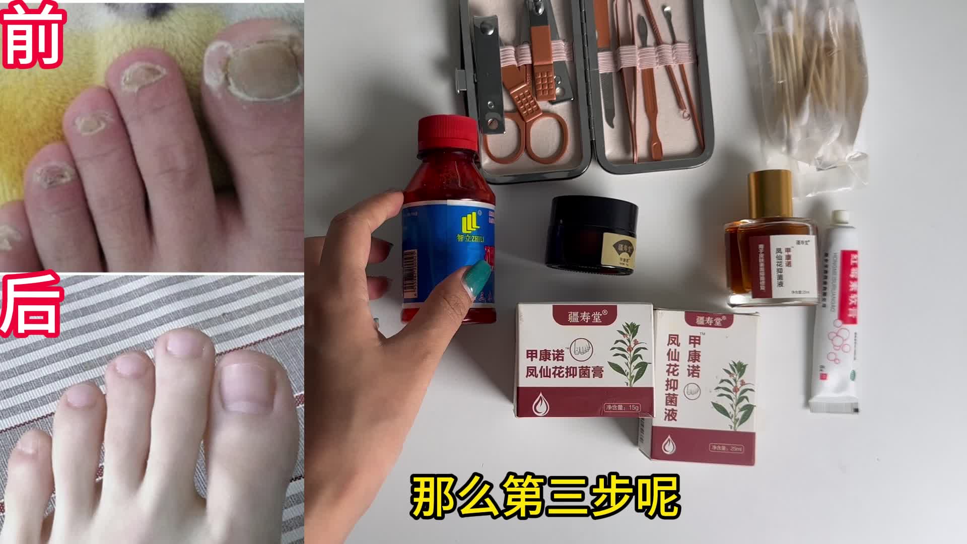 被800人追着问的祛灰秘籍它来了！简单几步，灰指甲秒变光洁新甲！