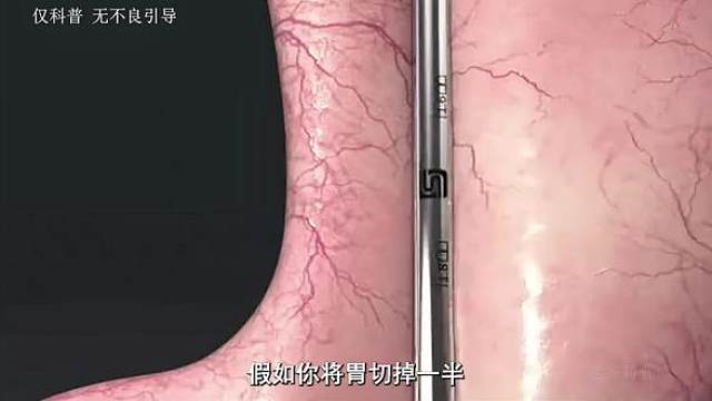 时间会让你在身上留下印记吗？#左旋 #左旋十万 #科普