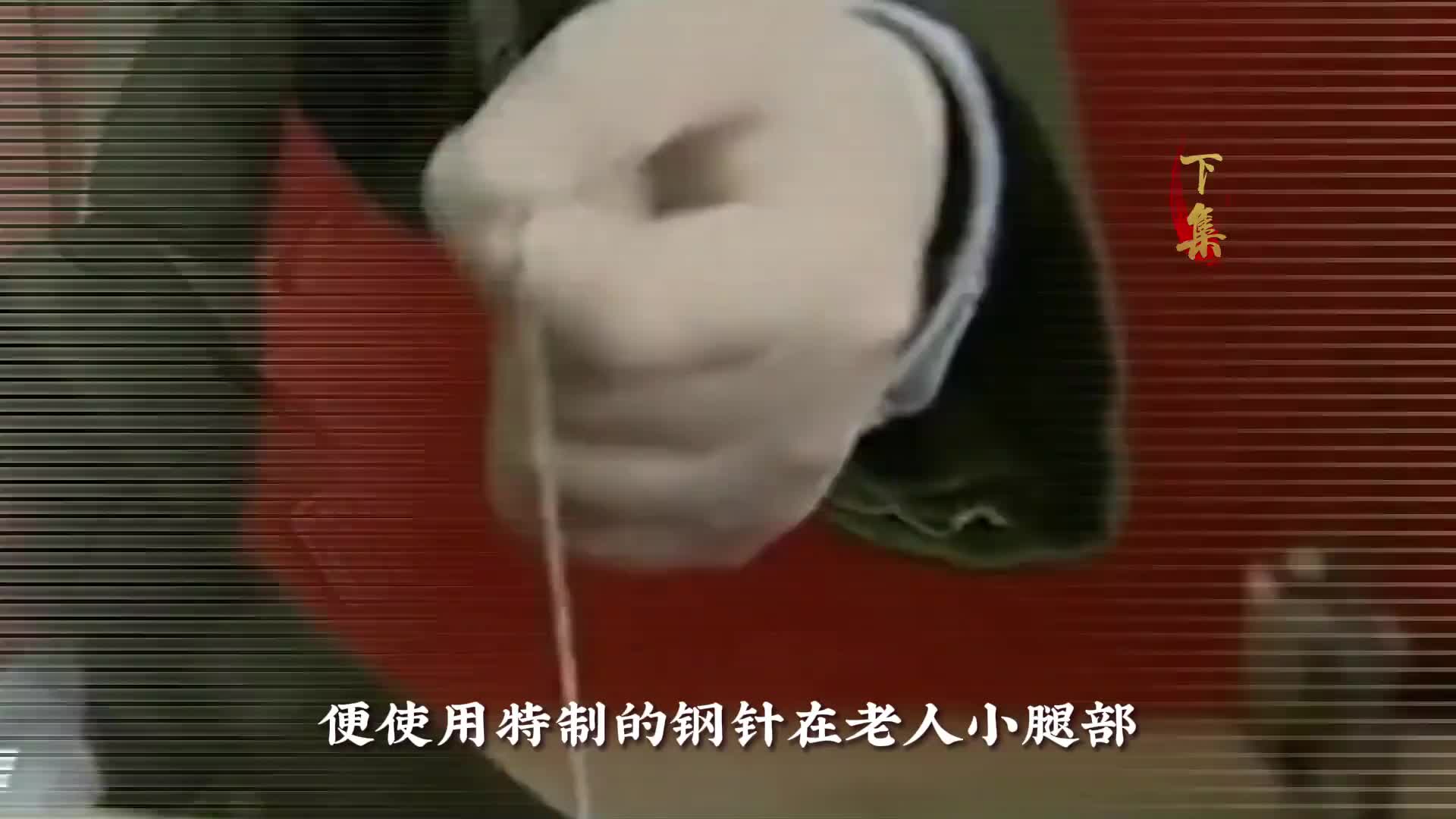 河北老人周凤臣，去世30年尸身不腐，就连血液都能正常流动！