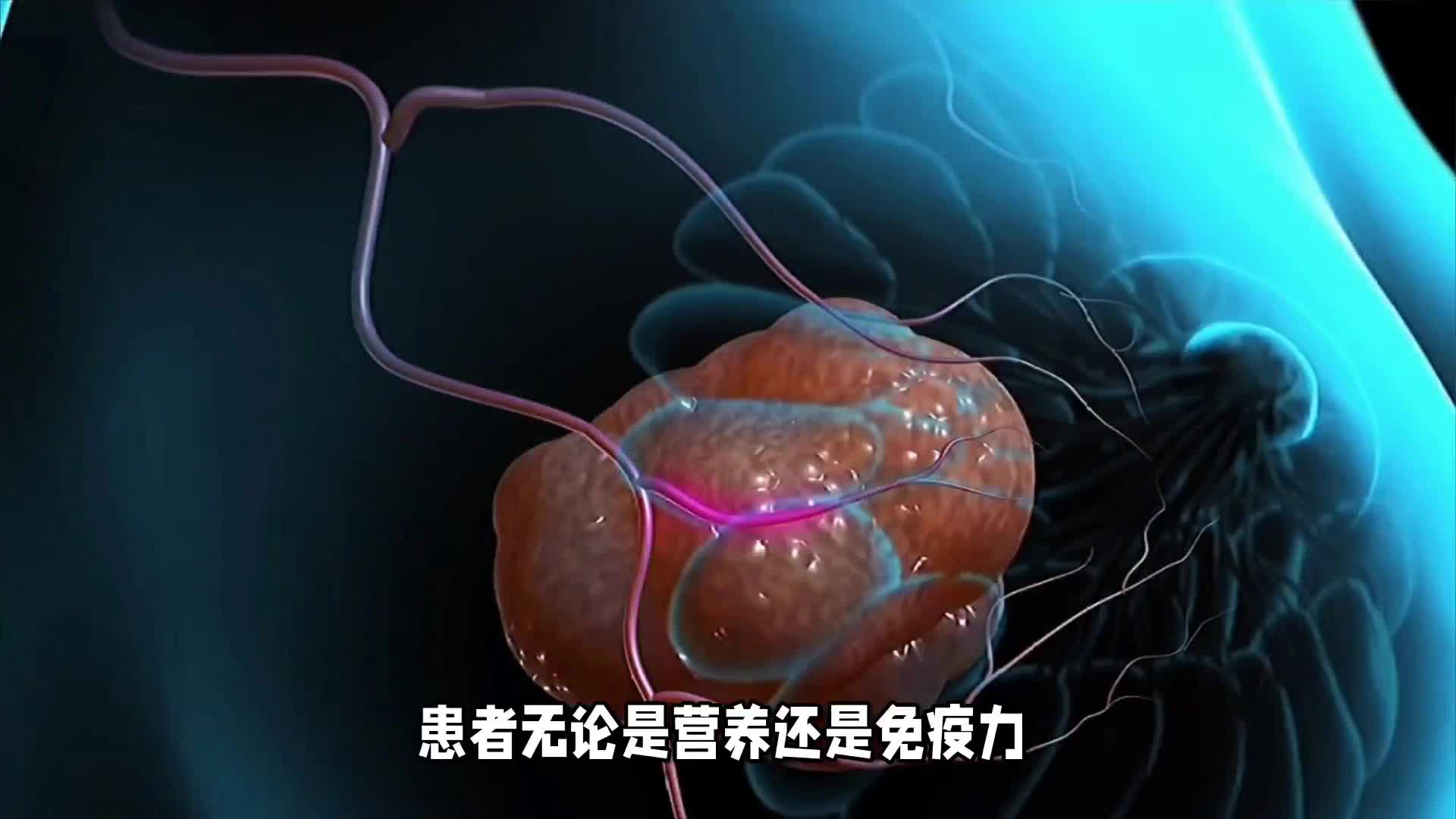 5种癌症患者不需要化疗