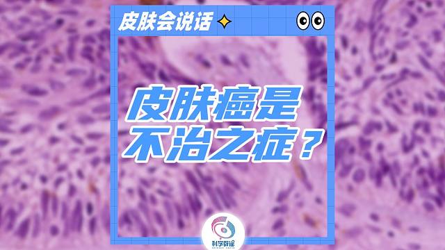 皮肤癌是不治之症？