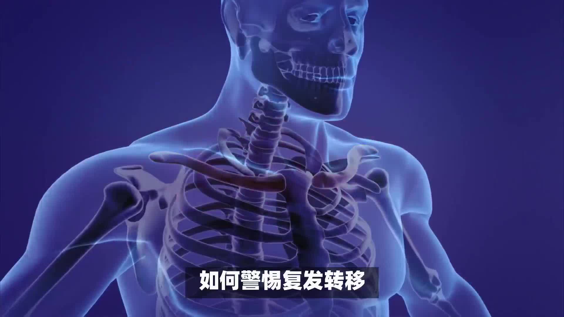 肺癌复发率有60%，要注意这个细节！