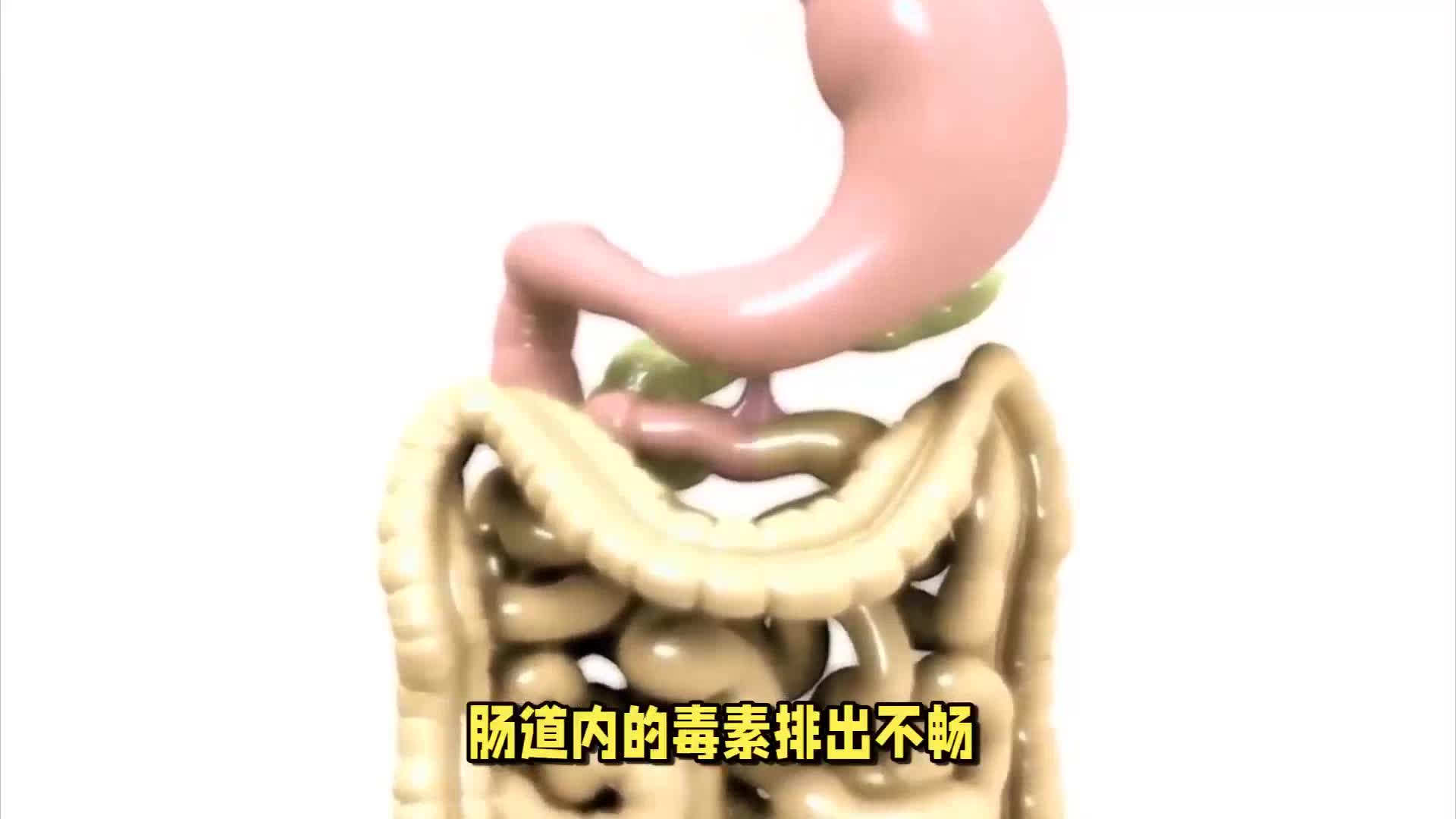 肠道菌群失调的5种迹象