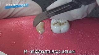 我給智齒看了視頻，它現(xiàn)在已經(jīng)不疼了。