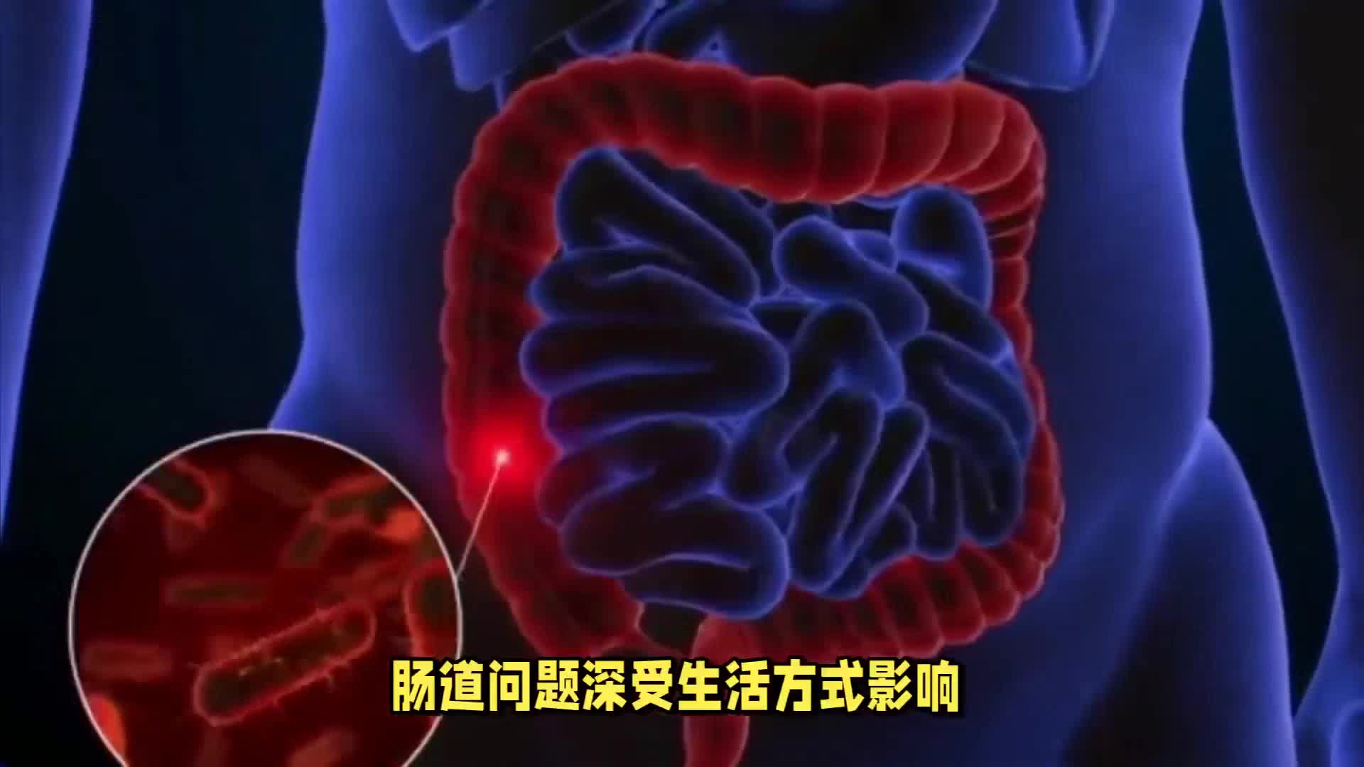 肠道闹“脾气”，这个帮大忙