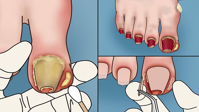 沉浸式超解压修脚动画卷土重来啦！|萌大佬动画