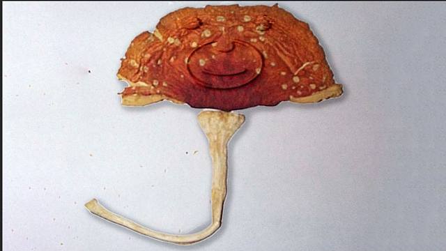 一位男性大量摄入了网购的毒蘑菇，这是他的大脑发生的变化