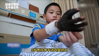 第3集｜9歲男孩被毒蛇咬傷，媽媽用菜刀劃開(kāi)兒子手臂，醫(yī)生：做得對(duì)?。ㄈ?展開(kāi)