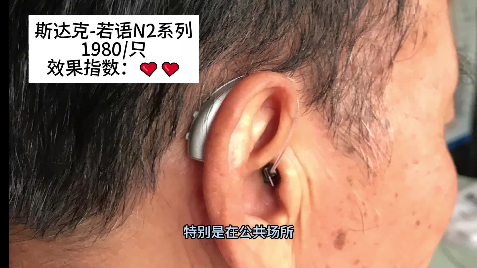 助听器选什么款式好？町石、斯达克、奥迪康、科大、创维助听器大测评！