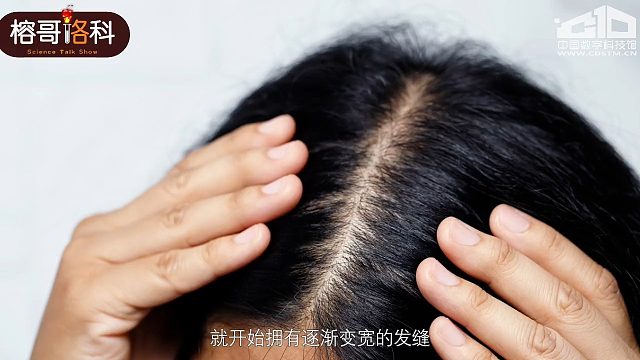 什么？年纪轻轻的也开始脱发了？