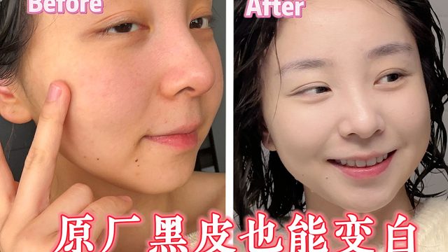 别再无效美白！外用护肤精华是永远干不过内调的...