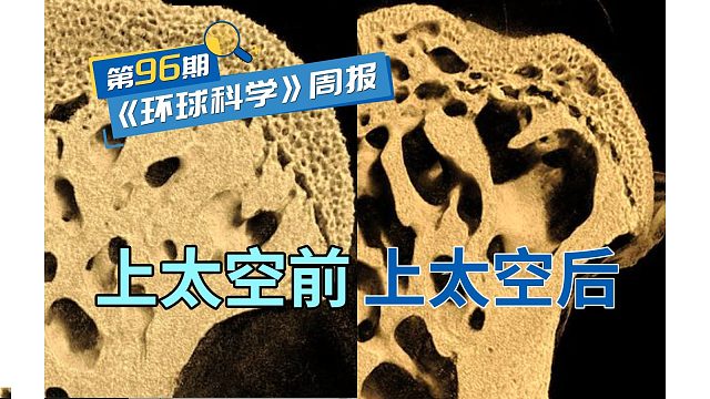 太空旅行一个月，腿骨里就全是大洞！医生：回不去了｜《环球科学》周报096期