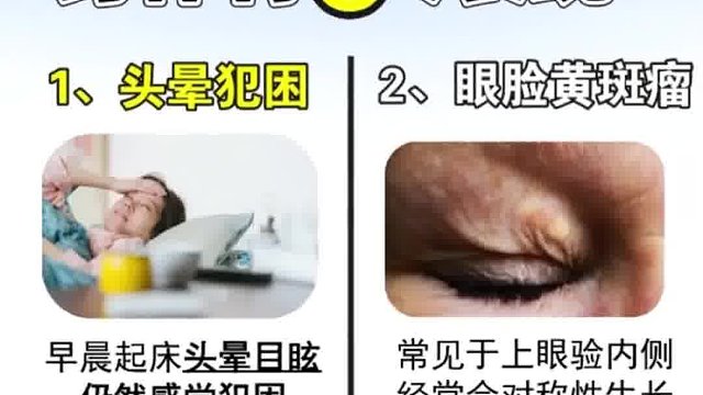 血脂高的6大表现，看看你有吗