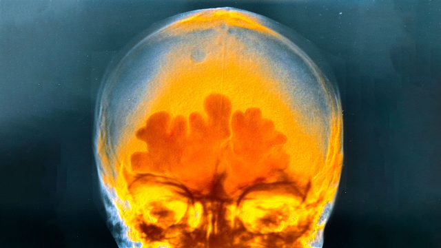 一位男性在晚上喝下了三勺马用电解质，这是他的大脑发生的变化