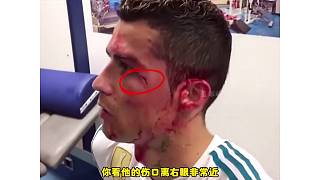 什么才是真男人，來看看c羅受傷后的表現(xiàn)你就知道了