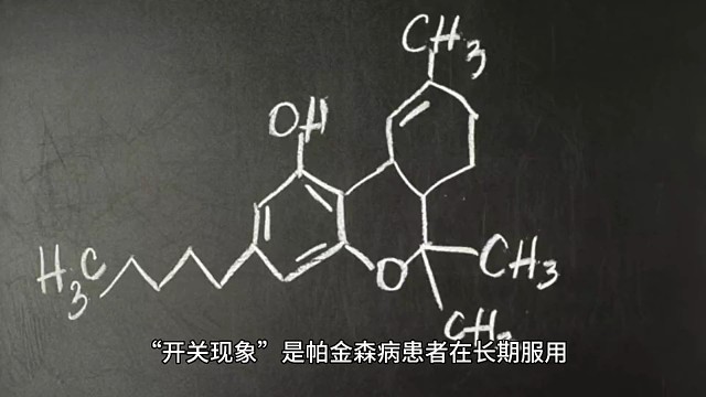 帕金森开关现象