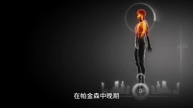 帕金森中晚期症状