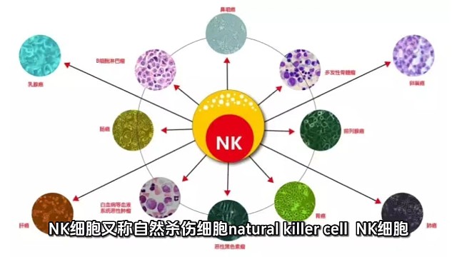 关于NK细胞，你需要知道这些＃希诺赛细胞存储