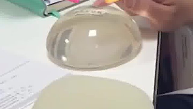 打架碎了会有生命危险吗？