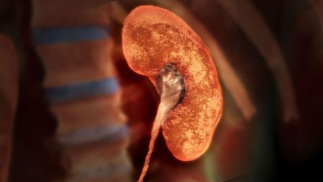 一个男性体内长了个长达二十余年的病灶，他的生活是这样被毁掉的