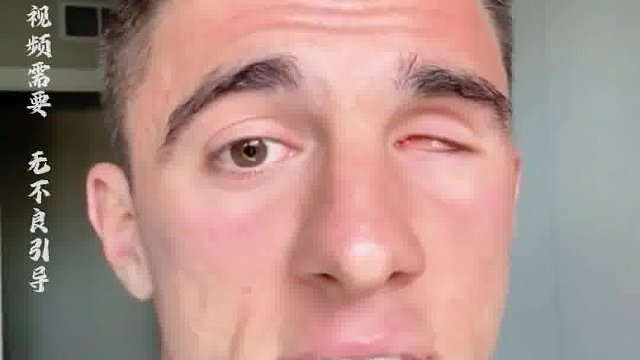 国外小伙每天都更换不同的眼睛，简直太酷了