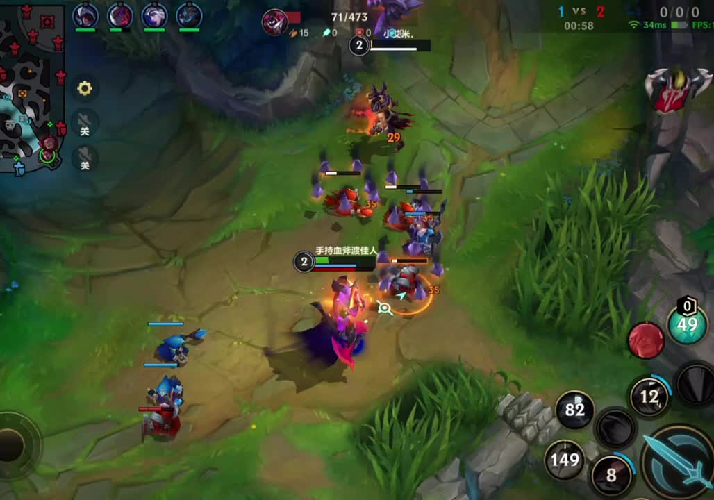 视野得分，是你为团队做的贡献